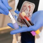 Resalta Secretaría de Salud la importancia de la detección oportuna de la hemofilia